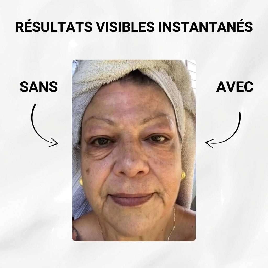 Instant V-Lift - Nivalea