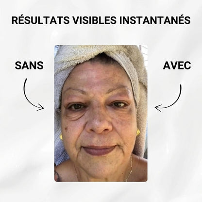 Instant V-Lift - Nivalea